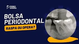 Raspa ou opera essa bolsa periodontal?