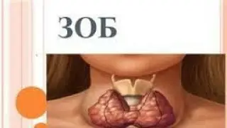 Бемории зоб (чоғар) Касалии зоб ё чоғар