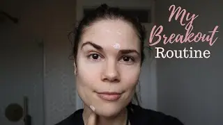 360° SKINCARE | MY BREAKOUT MUST HAVES