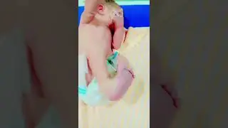 Newborn afterbirth#short#trending#viral