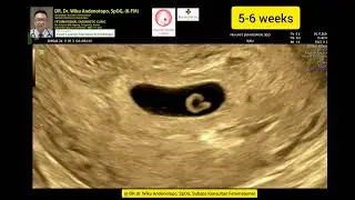 5-6 weeks