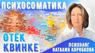 Отек Квинке Психосоматика