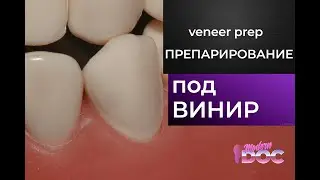 ПРЕПАРИРОВАНИЕ ПОД ВИНИР (подробная инструкция)