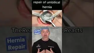 Fixing an Umbilical Hernia 😷 