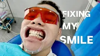 I have a problem with my smile