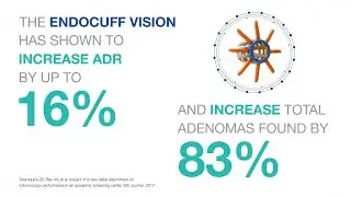 ENDOCUFF VISION Clinical Overview | 2017 Work
