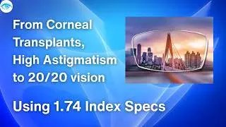 @eyeoptometrist From Corneal Transplants, High Astigmatism to 20/20 vision using 1.74 Index Specs