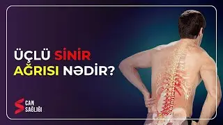 Üçlü sinir ağrısını yaradan səbəblər (20.06.2023) - Medical Meida Live