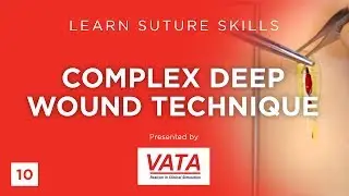 Complex Deep Wound Technique - Learn Suture Skills - VATA