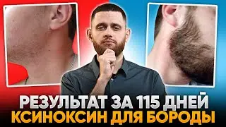 ЭТО СТАНДАРТ результатов. Посмотри и будешь понимать примерный результат от ксиноксина