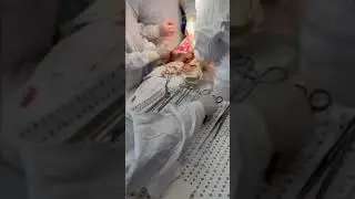 Вибіркова дисципліна "Оперативне акушерство"
