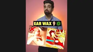 Ear Wax👂🏼🦠 *REALITY* 