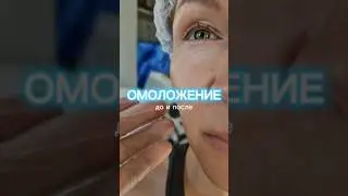ОМОЛОЖЕНИЕ ЛИЦА ОТ АЛЛЫ ПУГАЧЕВОЙ