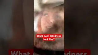 What does blindness actually look like? Let’s find out!