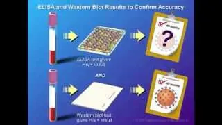 Diagnosis and Testing of HIV Infection