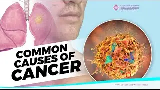 Top Causes of Cancer