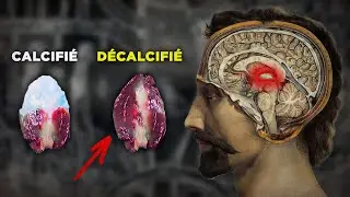 J'ai enfin réussi à décalcifier ma glande pinéale (voici comment)