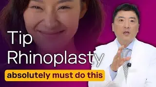 Tip Rhinoplasty: If you don’t remove this, it’s guaranteed to fail. Your nasal tip droops when you