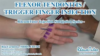 FLEXOR TENDONITIS / TRIGGER FINGER INJECTION - Simulation Series