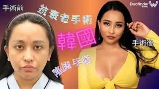 印尼網路紅人Chea Nuh的韓國整形之旅：下眼瞼矯正 | 魔滴隆胸 | 面部提升 | 安多泰提眉