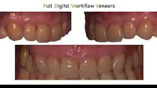 ObiScanner Case Study - Guided Surgery