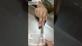 Card test for ulnar nerve | Ulnar nerve injury