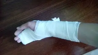 Я СЛОМАЛ РУКУ !!!