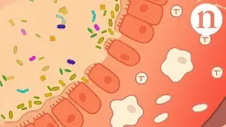 Ulcerative colitis: Fresh approaches to taming inflammation