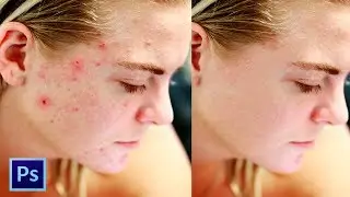 A melhor  maneira de tirar manchas com o Photoshop ( dicas para  wacomm)