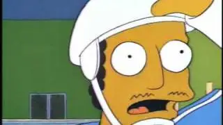 burns