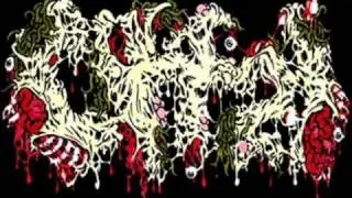The Ultimate Brutal Death Metal/Goregrind/Porngrind Compilation Part 35