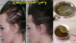 واخيرا استرجعت شعري وصفة سحرية تقوي و تطول الشعر وتملأ الفراغات وتعالج حتى الشيب