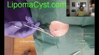 Dr Khaled Sadek Live Chat  17rd December  2023.