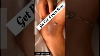 Get Rif Of Dark Spot/Darkness Remove From Feet & Hand ll #skincare #tanremove #ytshorts #viralvedio