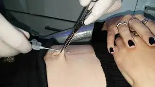 Painless Ankara Belly Piercing - The Importance of Lightness of Hand