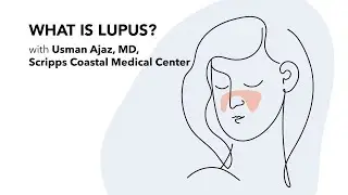 How to Diagnose and Treat Lupus