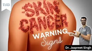 How do you know if you have skin cancer!