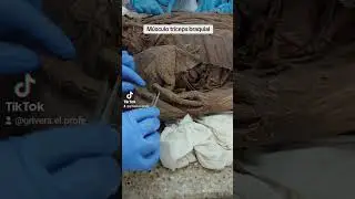 El músculo tríceps braquial