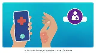 National Burns Awareness Month Burns First Aid