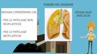 Il progetto CCM ex esposti amianto