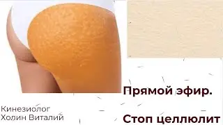 Прямой эфир от 27.01.21. Стоп целлюлит