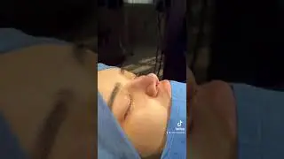 Нозим Шокирович. Ринопластика носа. Душанбе Таджикистан.