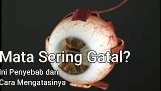 MATA SERING GATAL ❓ Inilah penyebab dan cara mengatasinya