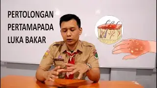 PERTOLONGAN PERTAMA PADA LUKA BAKAR