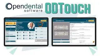 A Quick Look at ODTouch