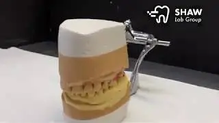 Dental Implants: Conventional Lab Workflow