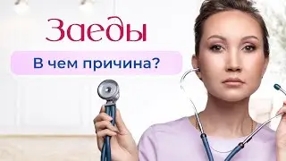 Заеды. В чем причина? Как избавиться от заед навсегда?
