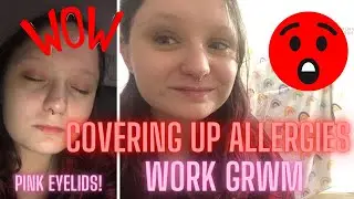 Covering Allergies For Work! -  GRWM -  Madalada Munden