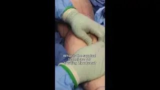 MLE™ Surgical Technique