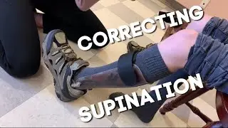 Custom AFO fitting - Supination Foot Correction